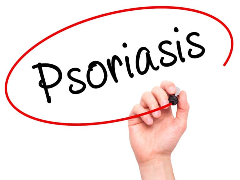 Personal Care at Home Fowler CA - What Seniors Should Know About Psoriasis