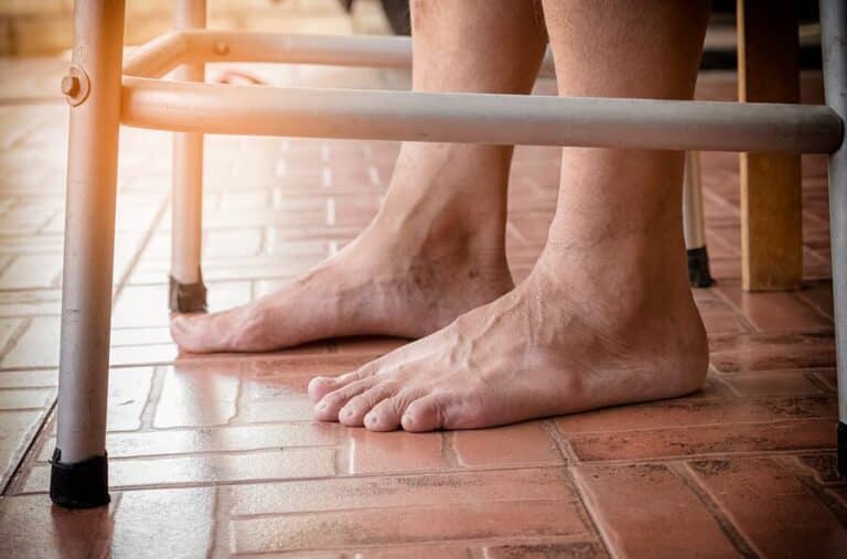 Personal Care at Home Sunnyside CA - Common Foot Problems Faced By Seniors With Diabetes